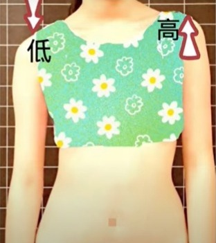 臺灣脊骨矯治醫學會 脊椎側彎 肩膀高低