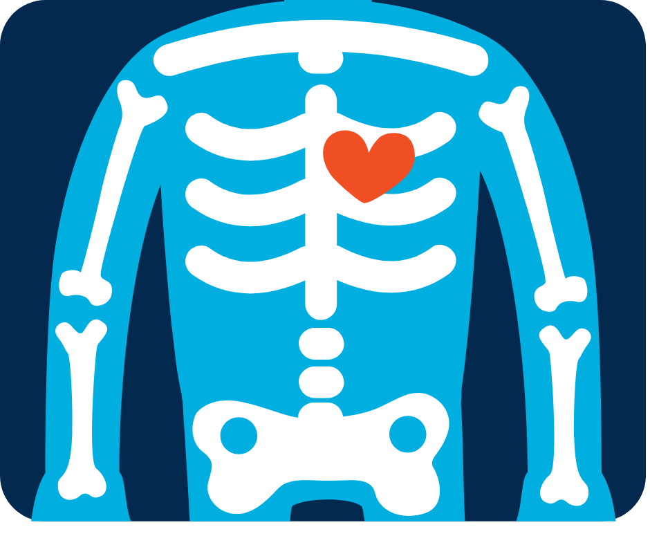 脊椎側彎 全脊椎X光片